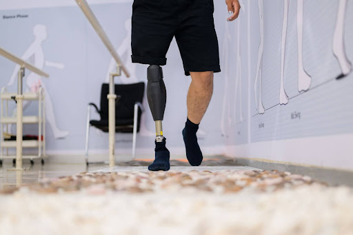 Man with a prosthetic leg walking at a rehabilitation center.